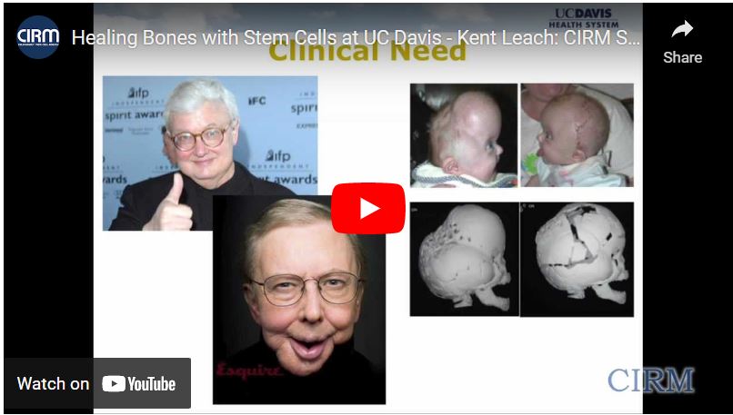 Leach Lab Healing Bones You Tube Video